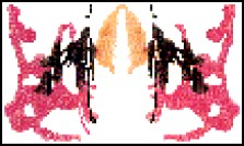 Rorschach